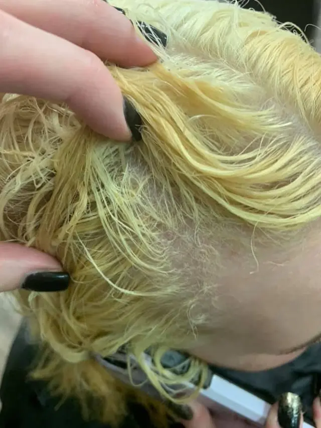 8 Potret Orang Gagal Semir Rambut, Ada yang Sampai Bengkak