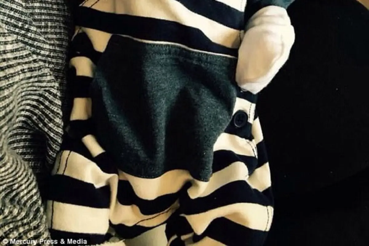 Bayi Alfie yang memiliki raut wajah pemarah. (Sumber Foto: Dailymail)