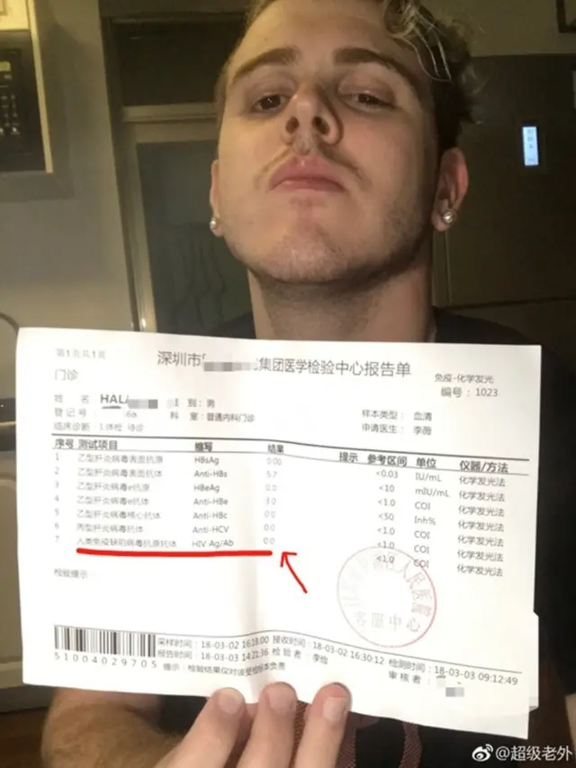 [Bintang] Digosipkan Kena AIDS karena Gonta-ganti Pacar, Pria Ini Coba Bungkam Netizen dengan Sepucuk Surat