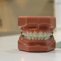 Ilustrasi bracket kawat gigi, behel. (Photo by Yingpis Kalayom on Unsplash)