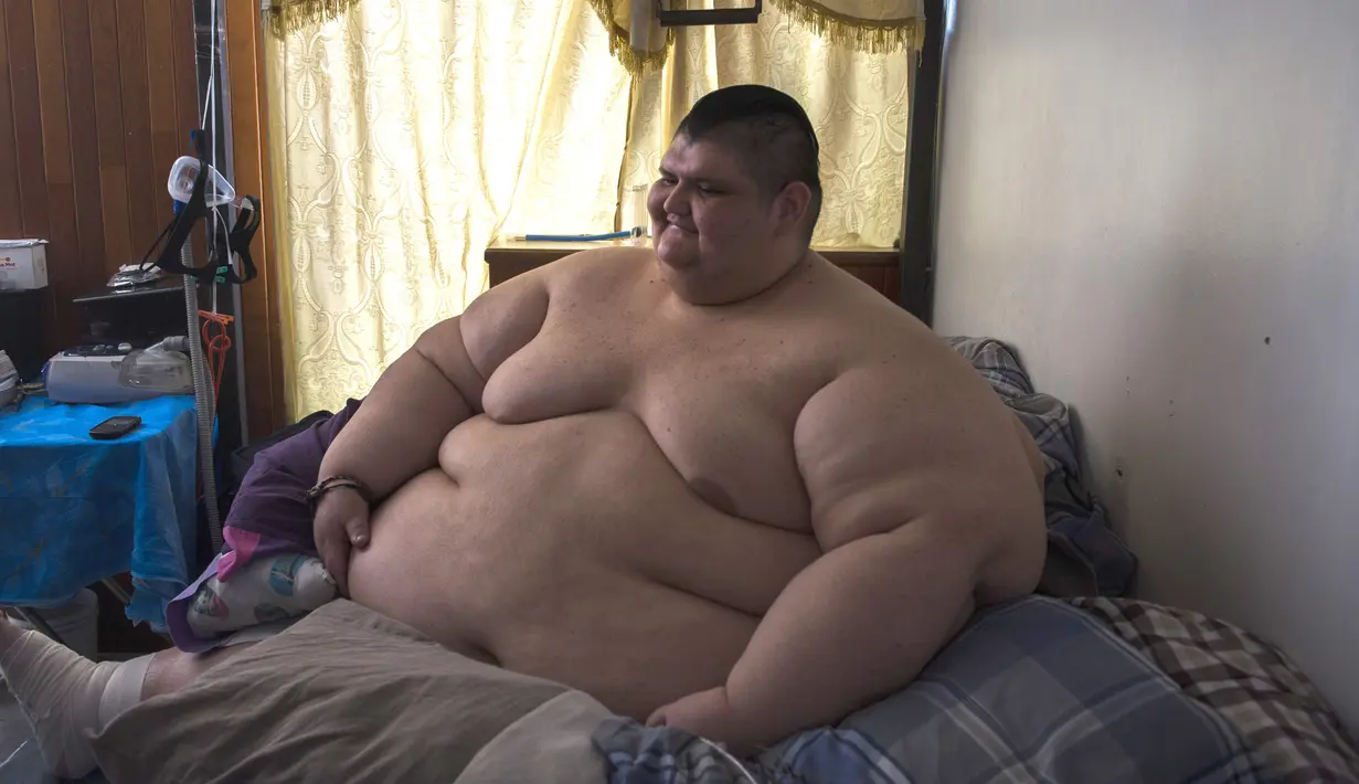 Juan Pedro Franco saat berada di kediamannya di Guadalajara, Meksiko (28/3). Sebelumnya, Pedro memiliki berat badan mencapai 595 kilogram yang menyebabkan dirinya hanya bisa berbaring di tempat tidur selama 6 tahun. (AFP Photo / Hector Guerrero)