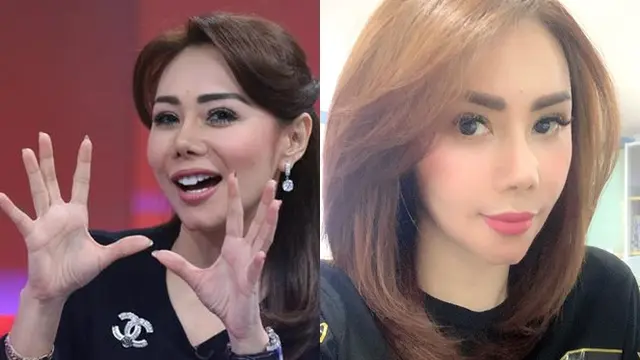 6 Selebriti Tanah Air yang Pernah Suntik Filler Bibir, Terbaru Lucinta Luna