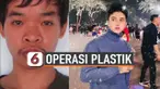 OPERASI PLASTIK