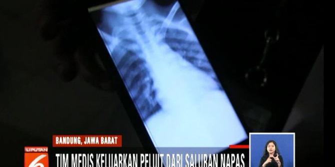 Peluit yang Tertelan Bocah di Bandung Berhasil Dikeluarkan