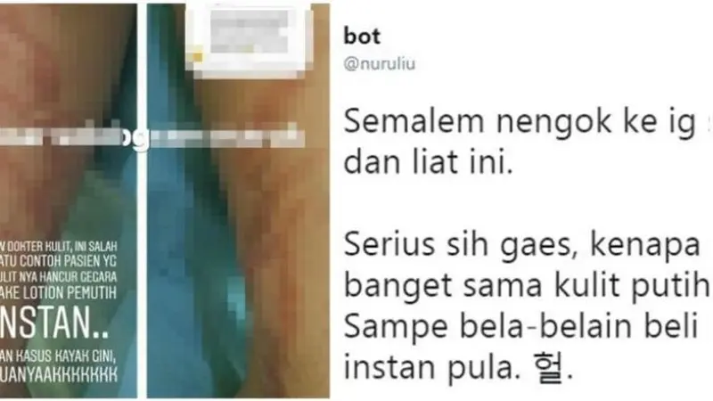 hati-hati jika pakai lotion pemutih (brilio/twitter)