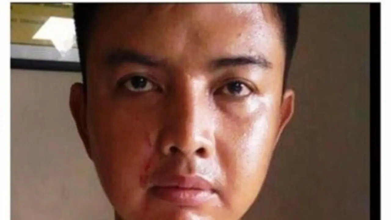 Kesal Karena Ditilang, Ibu Ini Cakar Muka Anggota Polantas
