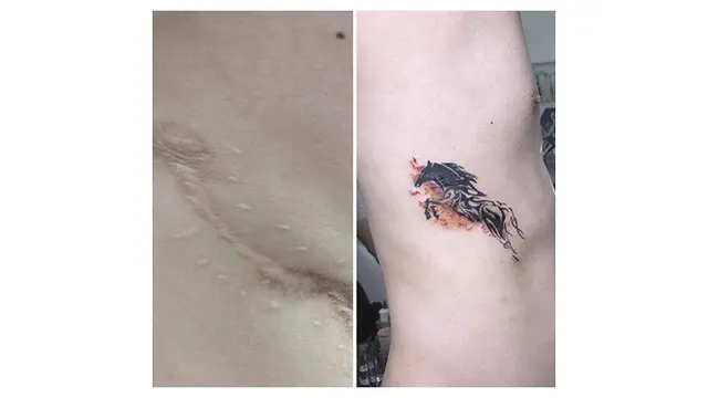 Wanita Ini Kreasikan Bekas Luka dengan Tato, 7 Hasilnya Mengagumkan