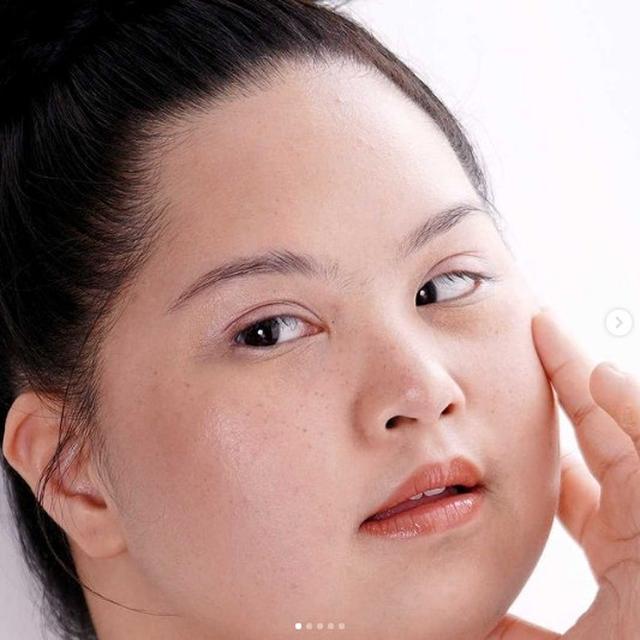 Brand Skincare Lokal Gandeng Model Down Syndrome di Kampanye Terbaru