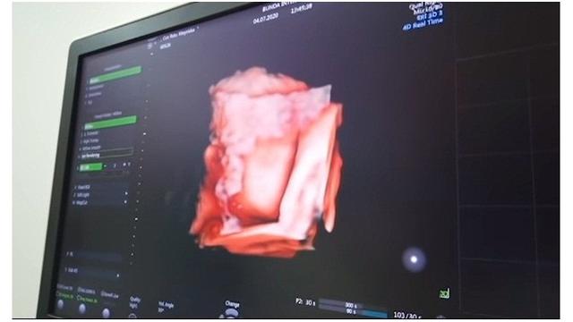 8 Momen Cut Meyriska dan Roger Danuarta Cek Kehamilan, Penasaran Wajah Anak