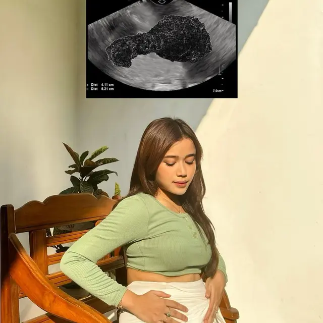 Brisia Jodie unggah foto USG