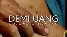 Polisi telah menggeledah RSCM dan menyita 14 dokumen terkait kasus ini.