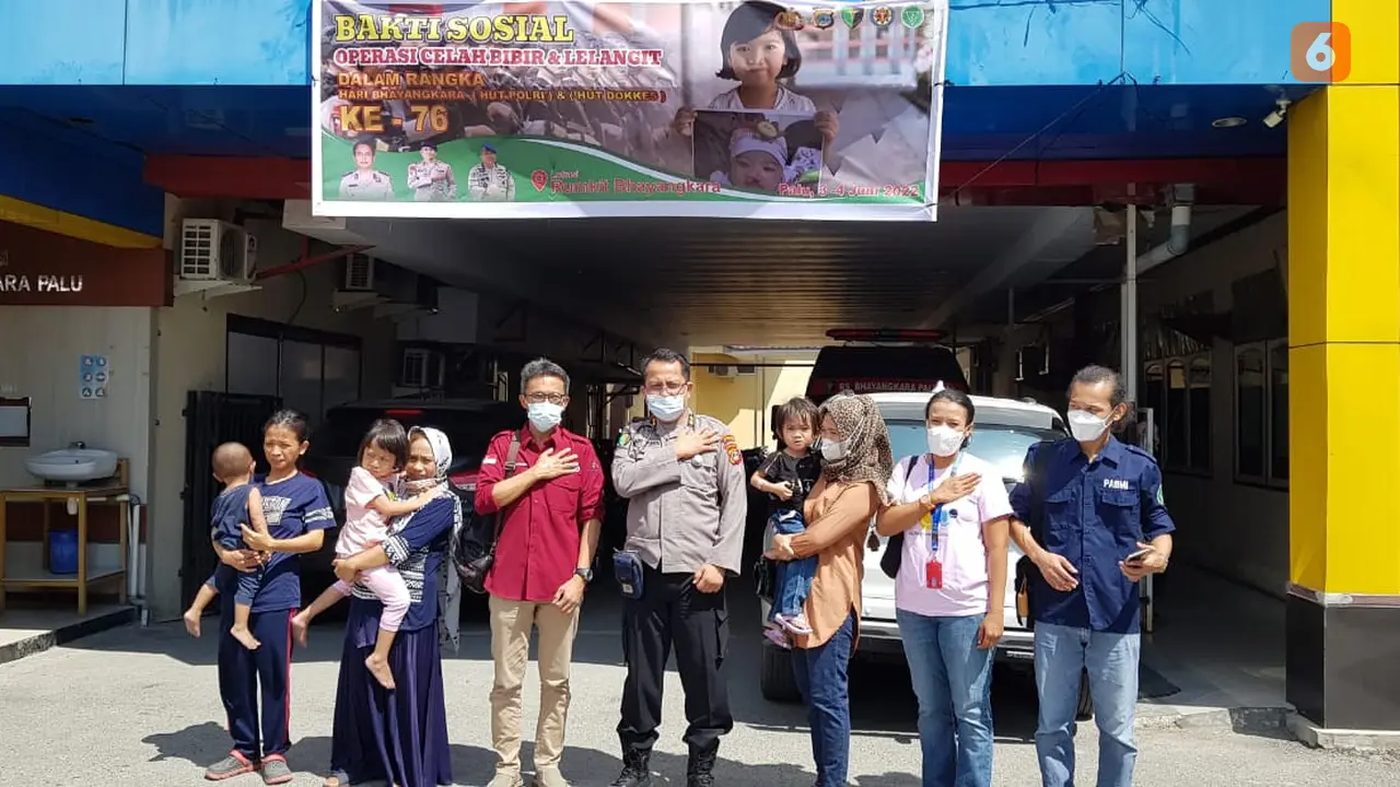 operasi gratis untuk penderita bibir sumbing di Kota Palu
