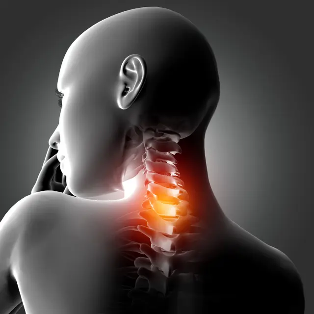 ilustrasi faktor penyebab osteoporosis/freepik.com