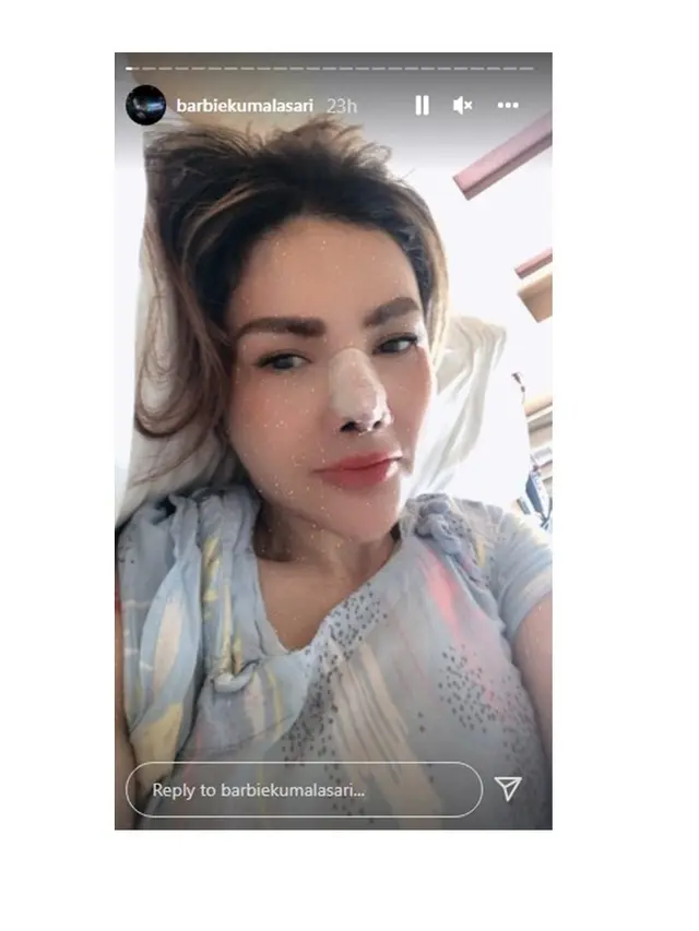 Kembali Jalani Operasi Hidung, Ini 6 Potret Terbaru Barbie Kumalasari