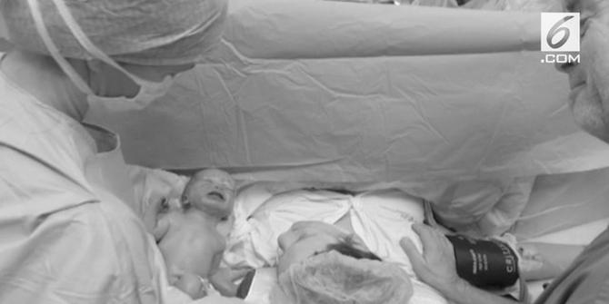 VIDEO: Bayi Lahir dari Transplantasi Rahim Donor yang Meninggal