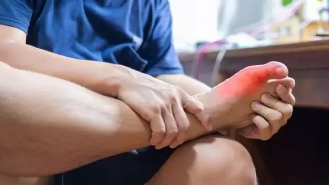 Nyeri Asam Urat. (foto: Pinterest/JawaPos).