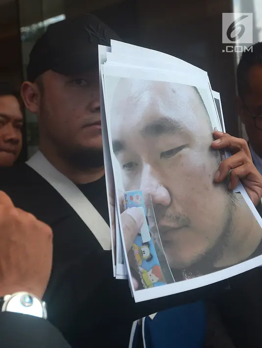 Pelapor penganiayaan, Ronny Yuniarto menunjukkan sebuah gambar usai membuat laporan di Polres Metro Jakarta Selatan, Kamis (21/6). Anggota Komisi III DPR Herman Hery diduga menganiaya Ronny Yuniarto bersama ajudannya. (Merdeka.com/Imam Buhori)