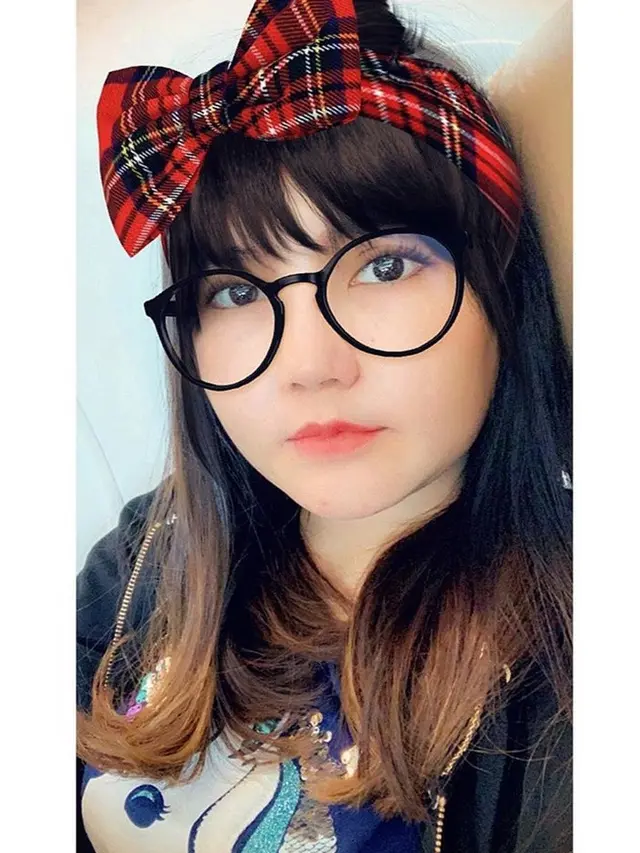 Akui Tengah Perawatan Pipi, Ini 7 Potret Terbaru Via Vallen yang Makin Chubby