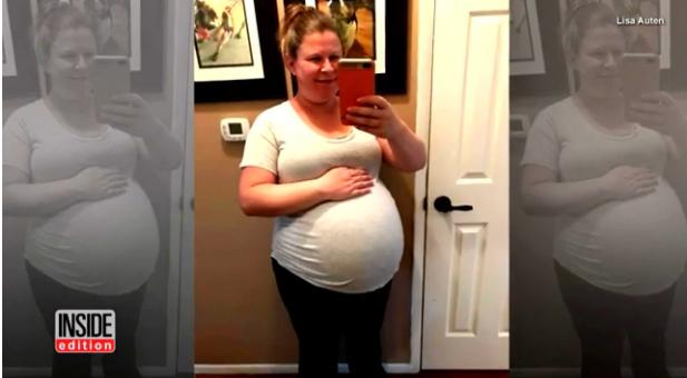 Lisa hamil anak kembar Melissa. | Foto: copyright insideedition.com