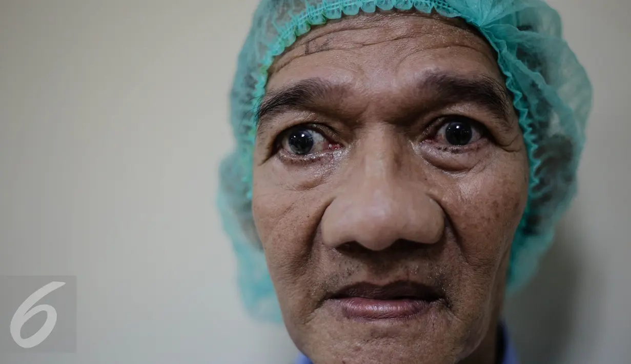 Seorang kakek menunggu antrian untuk diperiksa di Rumah Sakit Pusat Angkatan Darat (RSPAD) Gatot Subroto, Rabu (29/7/2015). Sebanyak 100 warga kurang mampu di Jakarta Pusat mengikuti pengobatan dan operasi katarak gratis.(Liputan6.com/Faizal Fanani)