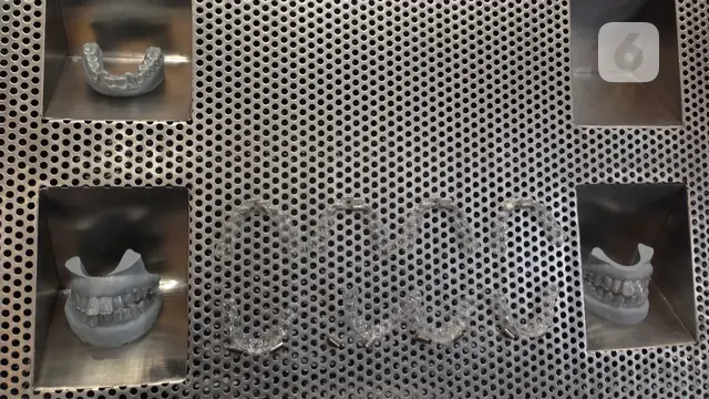 Clear aligner Rata