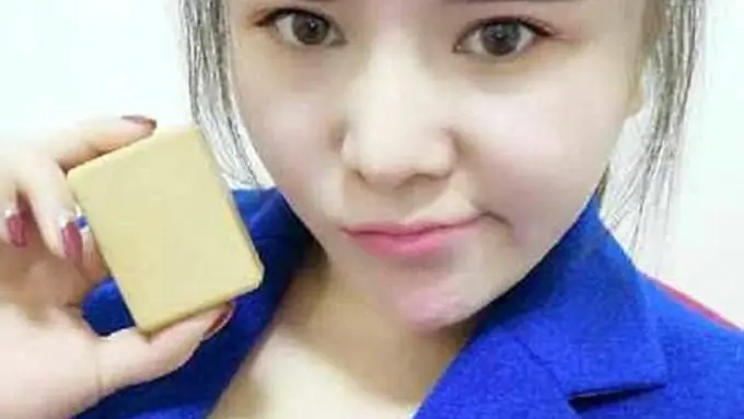 Pakai Lemak Tubuh, Wanita Ini Balas Dendam ke Mantan Pacar