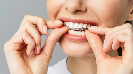 9 Arti Mimpi Gigi Copot Semua Yang Dianggap Buruk - Lifestyle Fimela.com