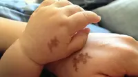 [Bintang] 10 Tanda Lahir dan Tatto Bekas Luka yang Keren Banget