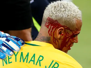 Pelipis Neymar berdarah usai bertabrakan dengan kiper Bolivia, Carlos Lampe pada laga kualifikasi Piala Dunia 2018 di Dunas Arena Stadium, Natal, Brasil, (7/10/2016).  (REUTERS/Ricardo Moraes)