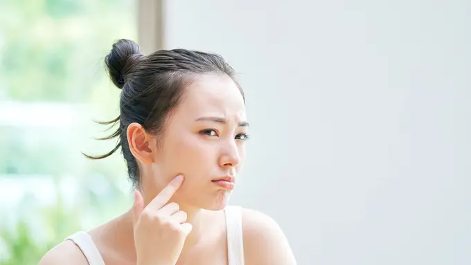 Penampilan Wajah Terganggu Akibat Flek Hitam? Yuk, Coba 4 Langkah Mudah Ini