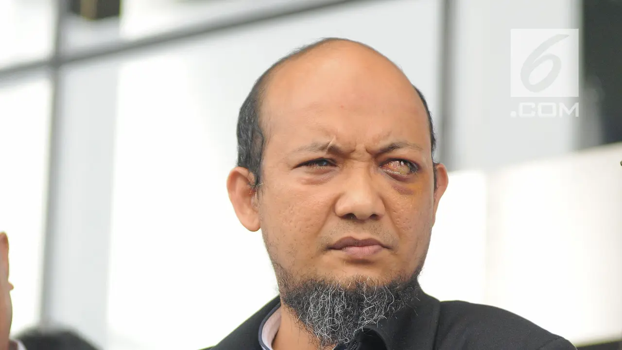 Sepuluh Bulan di Singapura, Begini Wajah Novel Baswedan