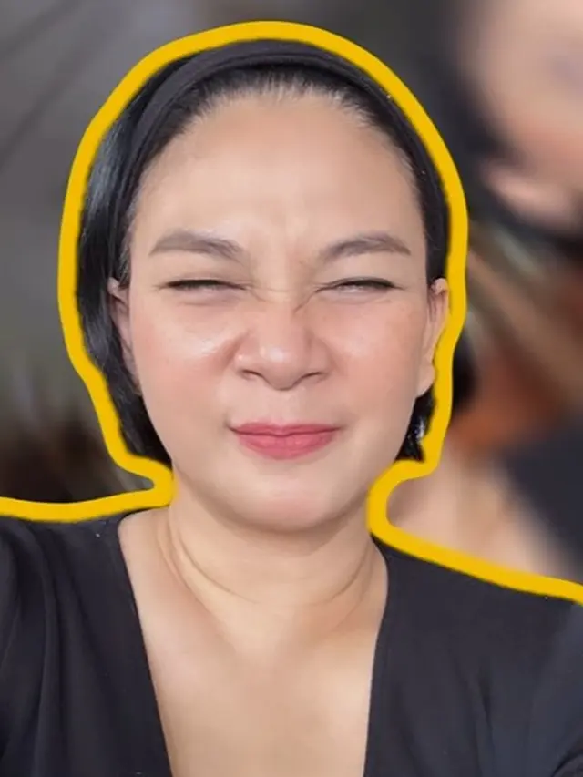 Dian Nitami lakoni oplas (Instagram/bu_deedee)