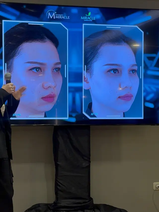 Facial Harmony 2.0 dari Miracle Aesthetic Clinic membuat wajah lebih Proporsional. [Anisha/Fimela]