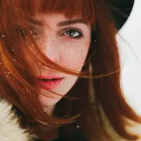 Ilustrasi freckles. (unsplash.com)