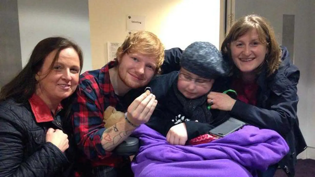 'Istri' Ed Sheeran Meninggal Karena Kanker Otak