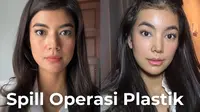 Raya Kohandi Jalani 5 Operasi Plastik di Korea Selatan, Perubahan Bentuk Hidungnya Disorot