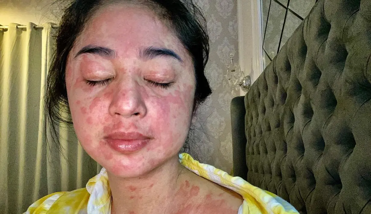 Dewi Perssik (Instagram/dewiperssikreal)