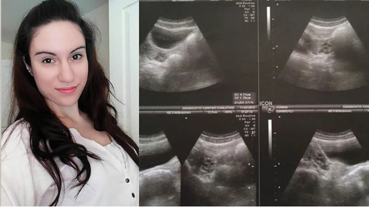 Gara-gara Idap Penyakit Langka, Wanita Ini Tak Punya Vagina
