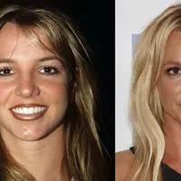 Britney Spears pernah mengaku pada Instyle bahwa dirinya melakukan lip injections. (Rex - Shutterstock - HollywoodLife)
