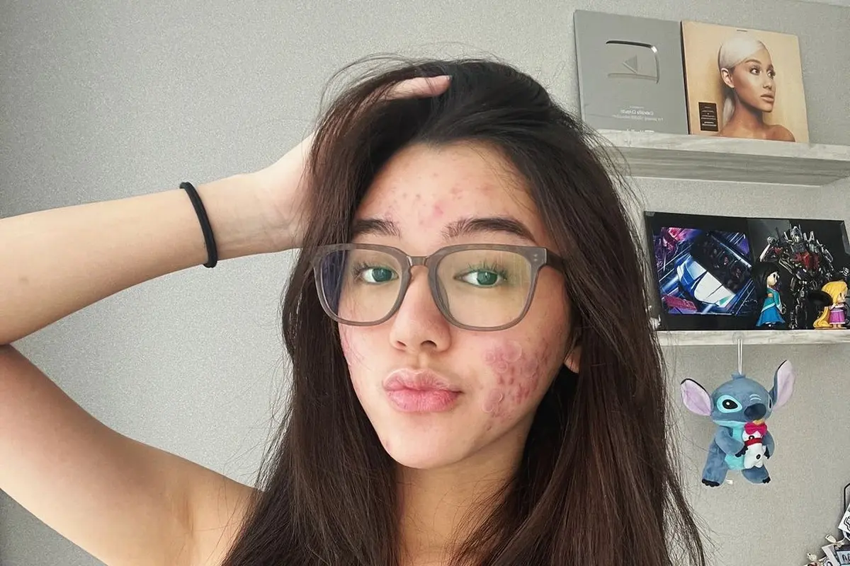 Potret Menawan Gabriella Eka Putri, Tampil Percaya Diri dengan Bare Face dan Berjerawat