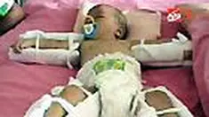 Bayi korban penganiayaan bernama Feri masih dirawat di RSUD Koja, Jakut. Walau relatif membaik, Feri harus menjalani perawatan lebih lanjut. 