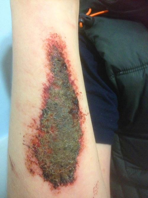 Jack alami luka ringan di tangan meskipun terjatuh dari ketinggian 700 meter | Photo: Copyright mirror.co.uk