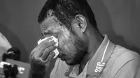 Pemain Malaysia, Faisal Halim menyeka matanya saat jumpa pers pemusatan latihan Selangor FC di Padang SUK Shah Alam, Kamis (13/6/2024). Terlihat luka bakar di sejumlah bagian tubuhnya akibat insiden penyiraman air keras oleh orang yang tak dikenal pada 5 Mei 2024. (AFP/Arif Kartono)