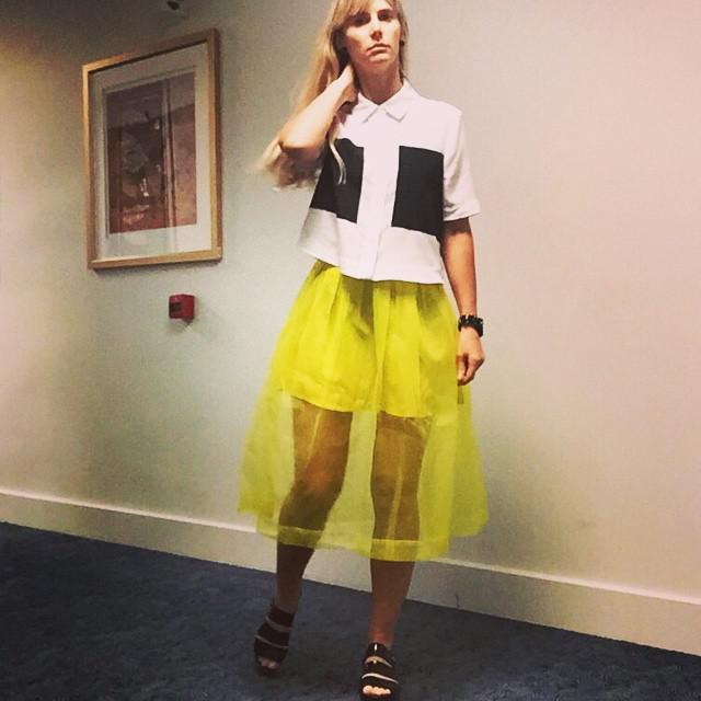 Day 1 Chemo Outfit (19/1/15) | copyright Instagram/shoe_vixon