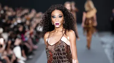 Model bernama Winnie Harlow menampilkan koleksi Spring/Summer 2018 untuk L'Oreal di Paris Fashion Week, Minggu (1/10). Namanya mencuat seiring dengan tertariknya orang memandang kulitnya yang bercorak putih. (AP Photo/Kamil Zihnioglu)