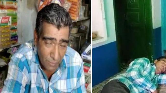 Punya Kondisi Langka Pria Ini Tidur 300 Hari Dalam Setahun Citizen6 Liputan6 Com