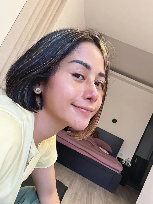 Potret Hasil Oplas Hidung Farida Nurhan