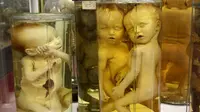 4 Koleksi Museum Ini Membuat Kamu Tak Bisa Tidur Nyenyak