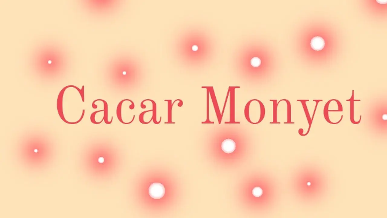Ilustrasi cacar monyet