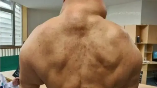 Pria mirip Hulk (Metro.co.uk)